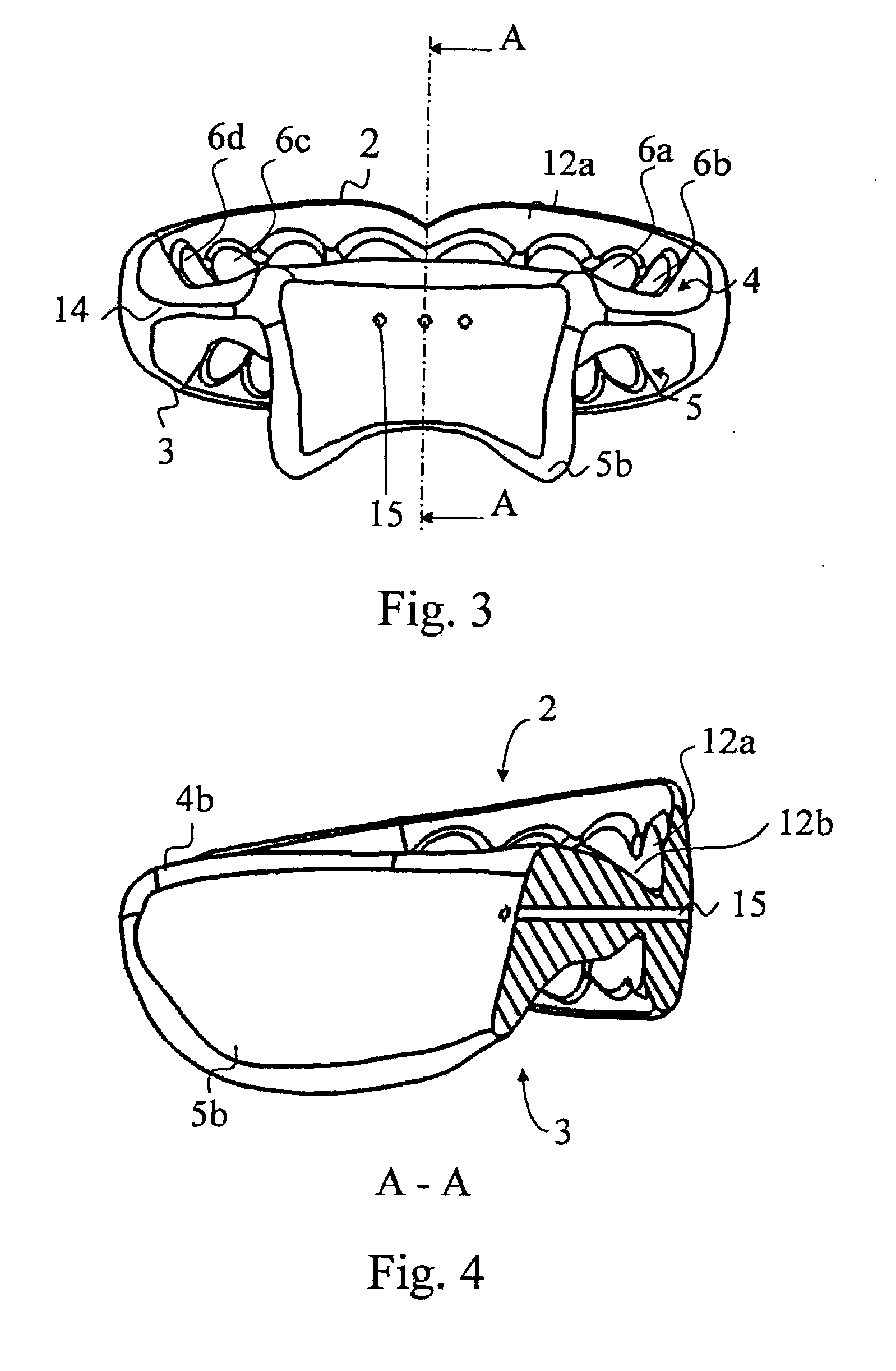 Orthodontic Activator