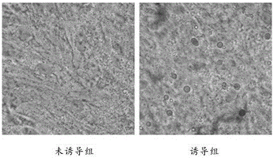Dental pulp mesenchymal stem cell cryopreservation solution and cryopreservation method thereof