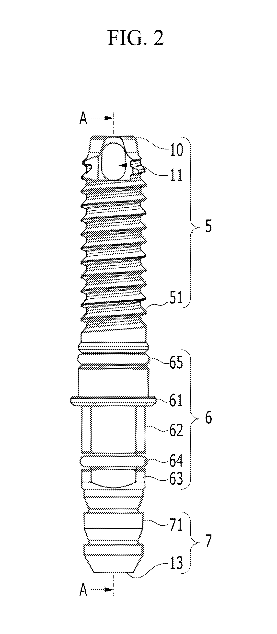 Dental sinus lift device for implant rehabilitation