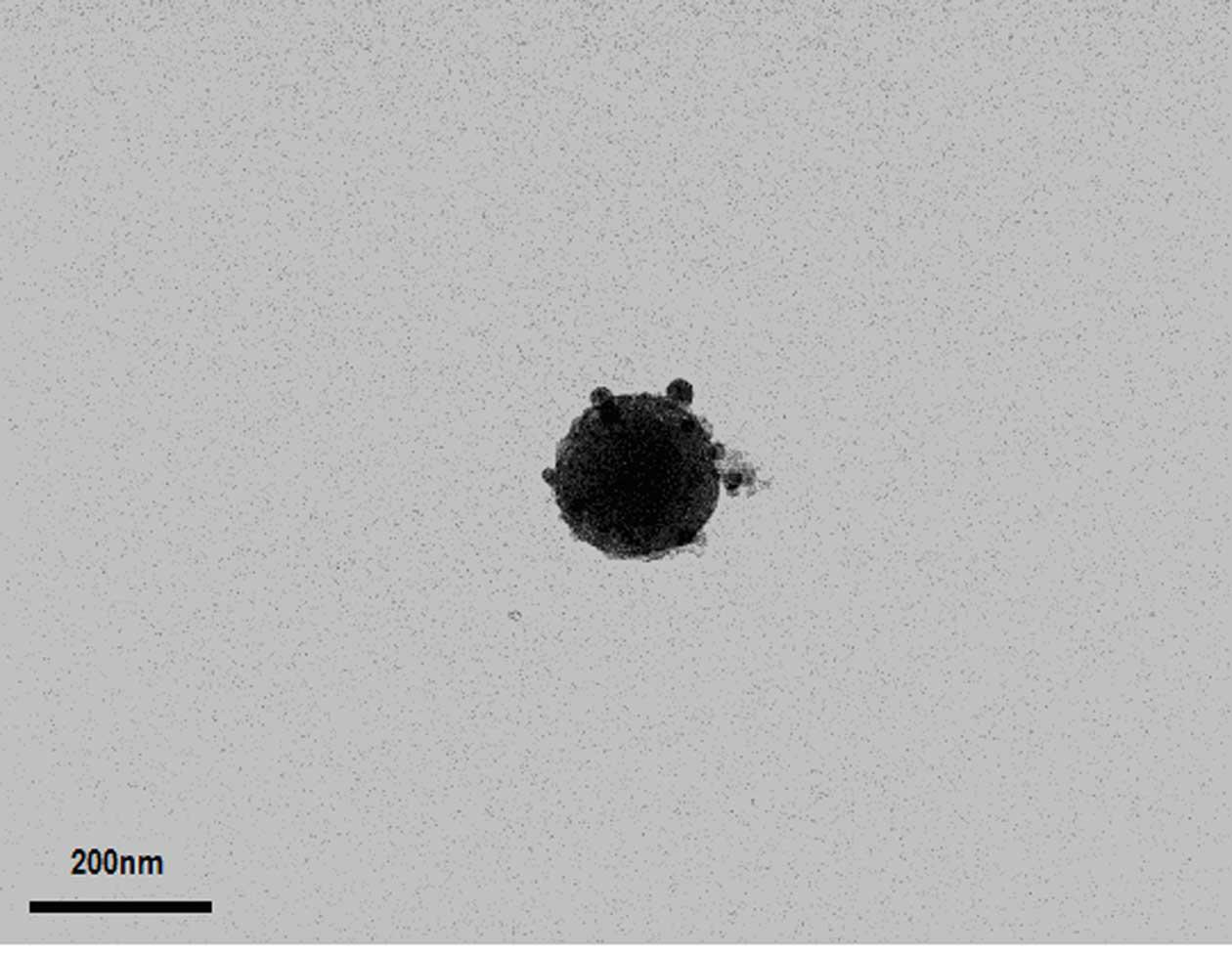 Method for preparing soft magnetic mesoporous nickel-zinc ferrite microspheres