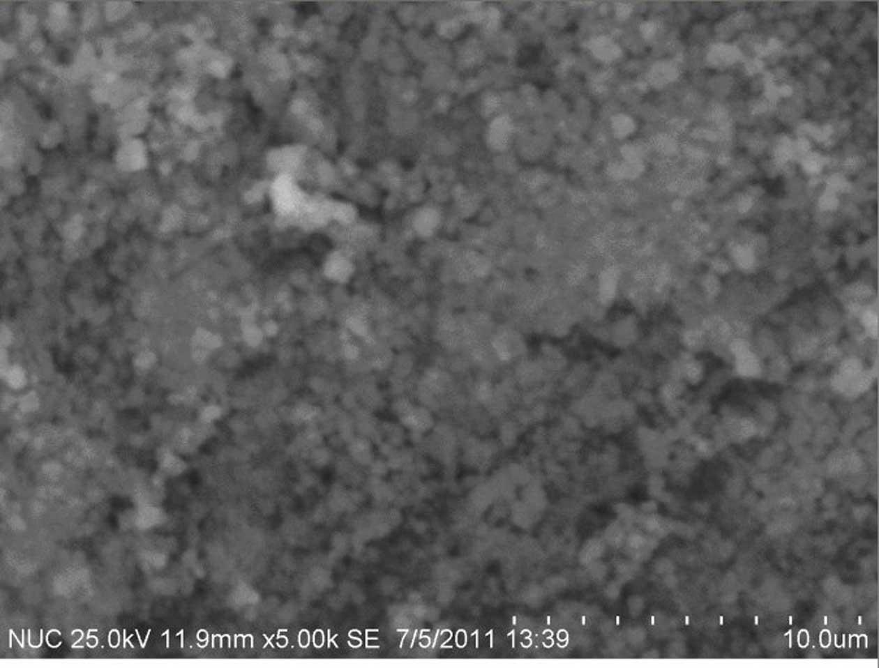 Method for preparing soft magnetic mesoporous nickel-zinc ferrite microspheres