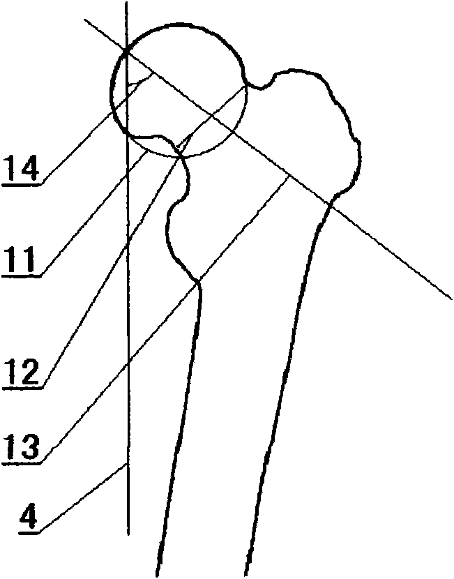 Method for measuring femoral head-neck spatial angles