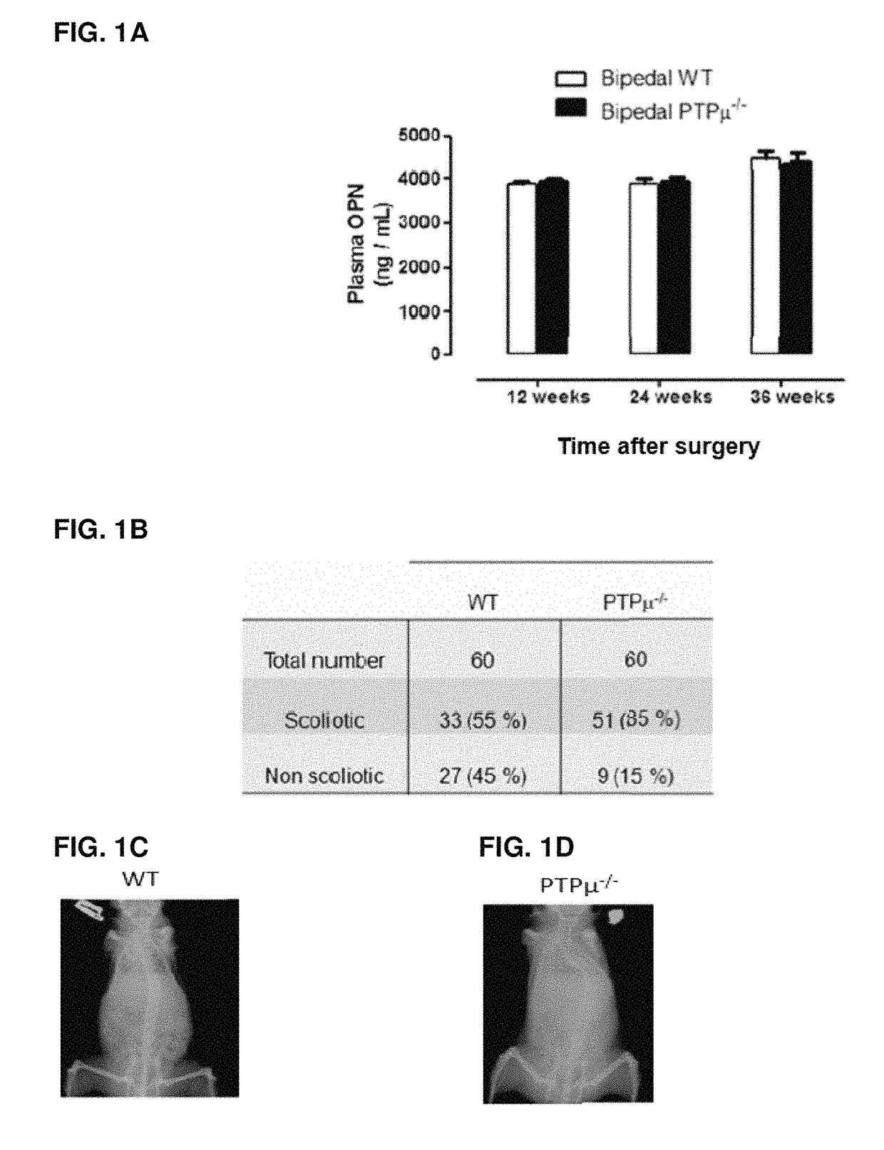 Composition comprising a cell sample from a subject with scoliosis and a reagent for detecting PTPμ or PIPK1y