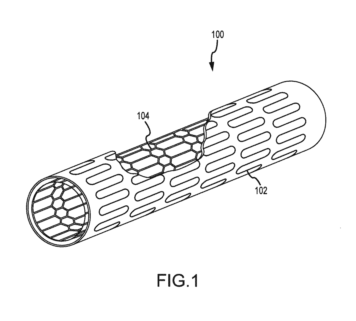 Post-implantation contractible or expandable devices and method of using and making the same