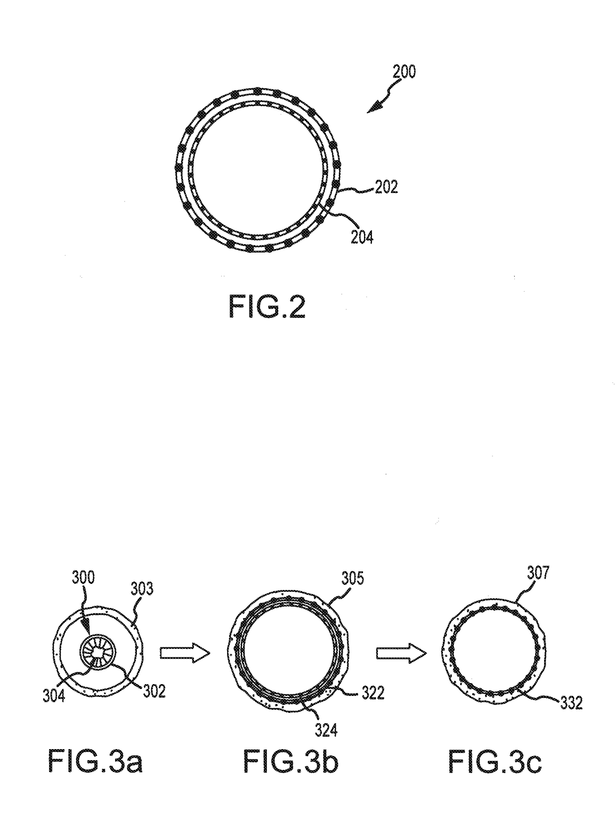Post-implantation contractible or expandable devices and method of using and making the same