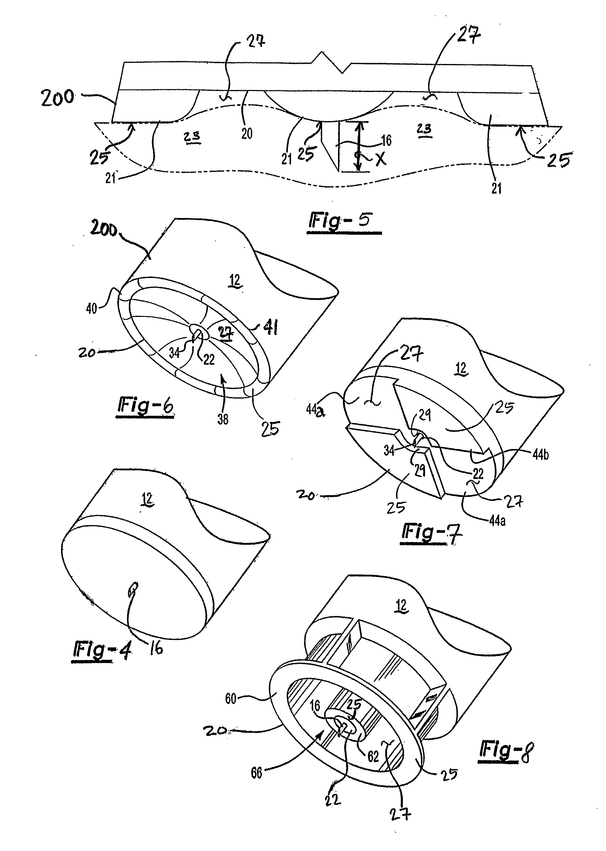 Intradermal Delivery Device With Crenellated Skin Engaging Surface Geometry