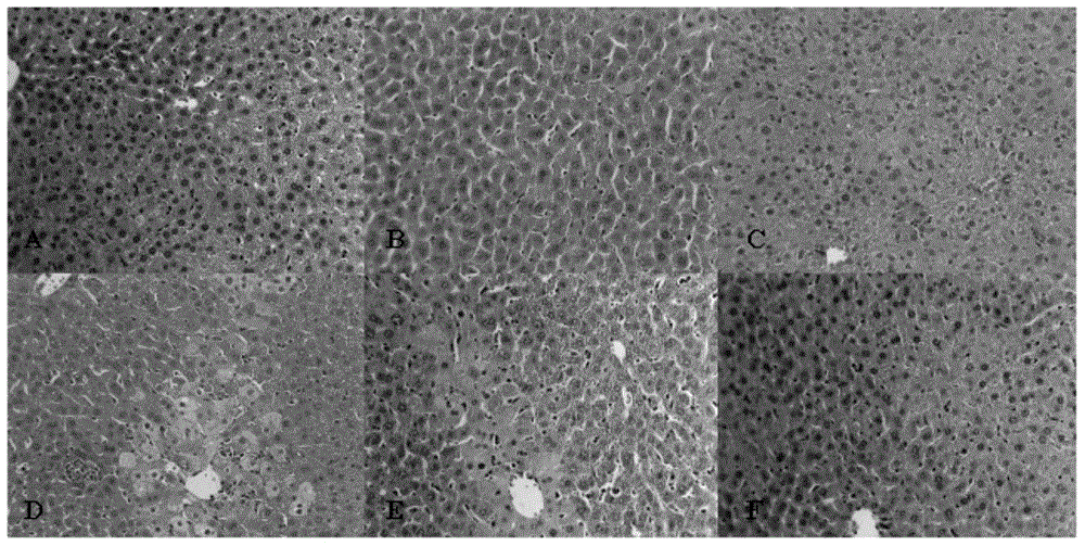 New application of N-(1-benzylpiperidine-4-amidogen)-2-(4-phenoxy benzoyl) acetamide