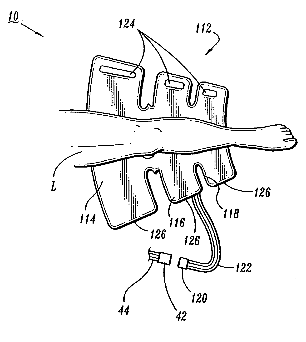 Garment detection method and system for delivering compression treatment