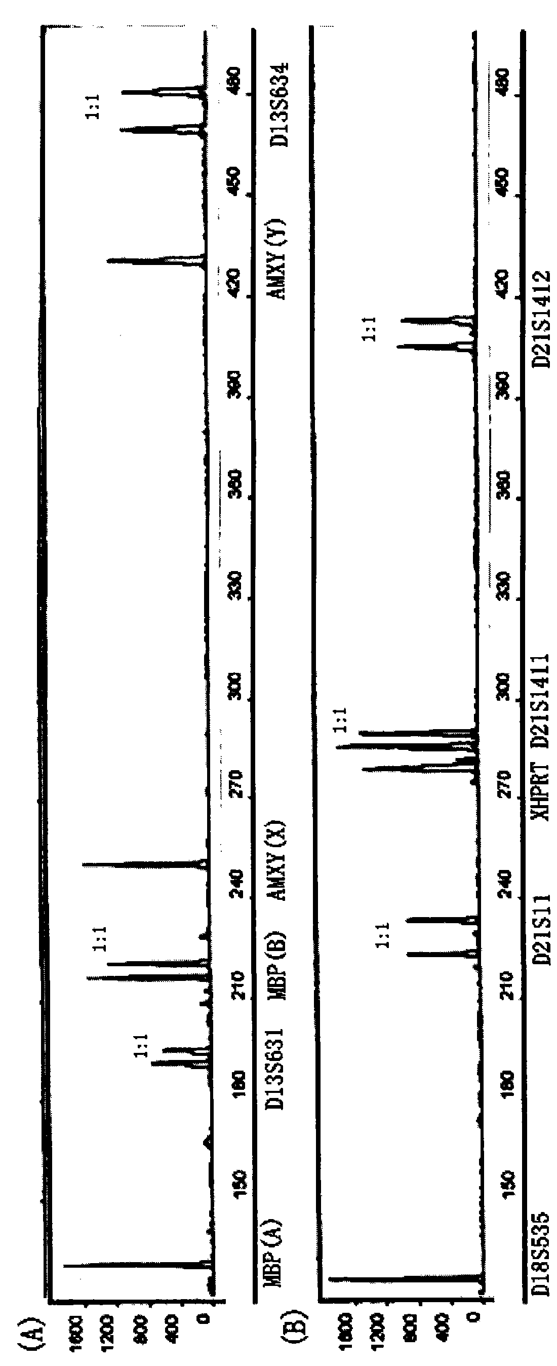 Reagent kit for fast detecting common chromosome trisome by quantitative fluorescence PCRs