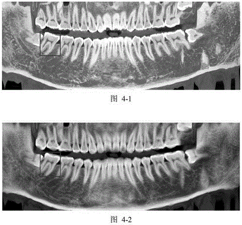 Method for extracting panoramic image from three-dimensional conical beam CT data of dentistry department