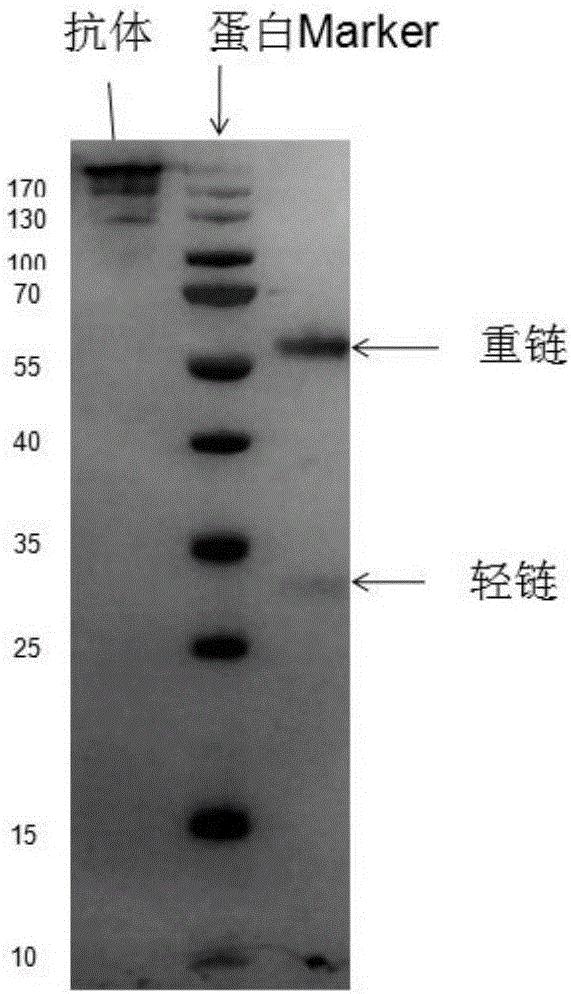 CFH antibody related with alternative pathway