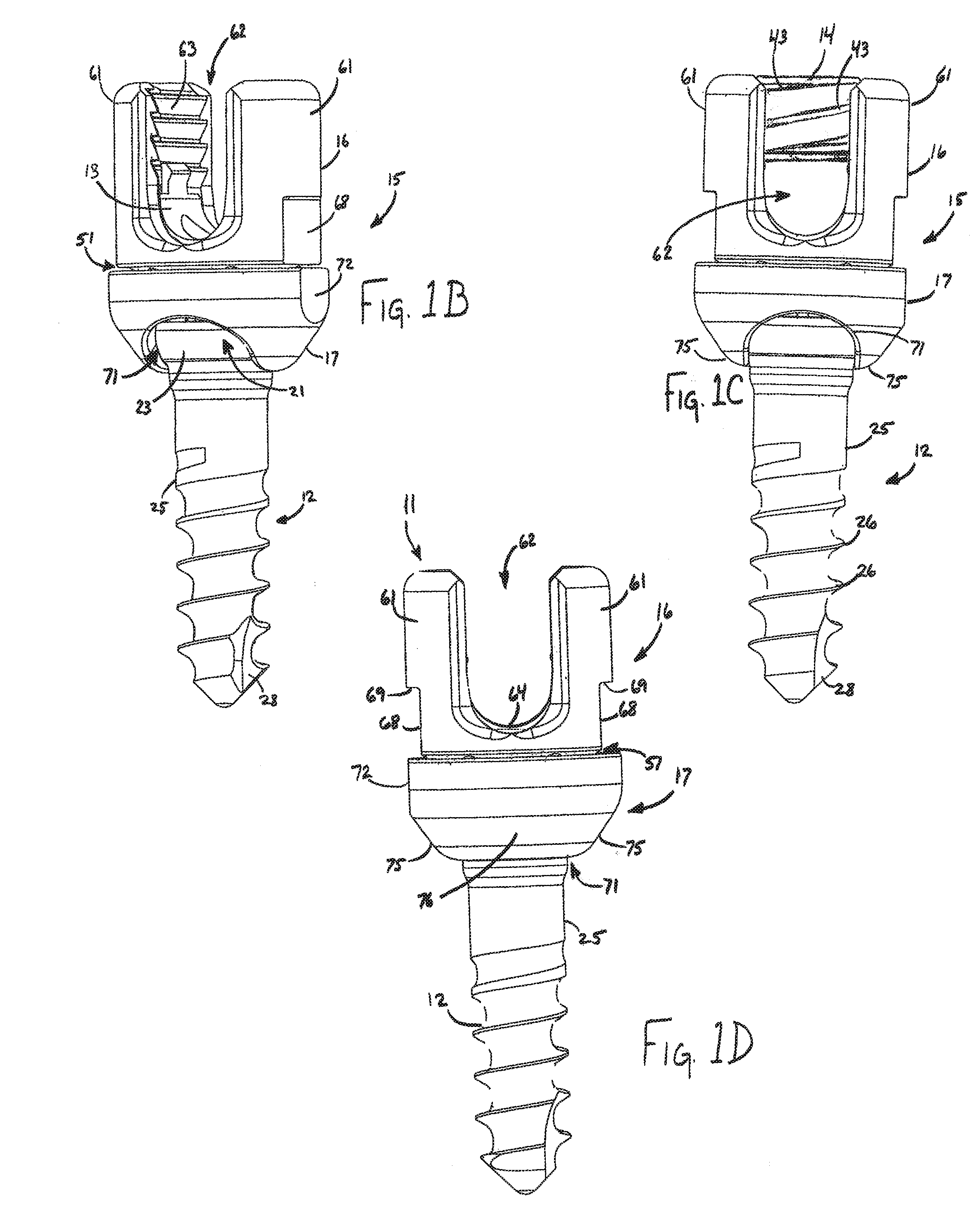 Wide Angulation Coupling Members For Bone Fixation System