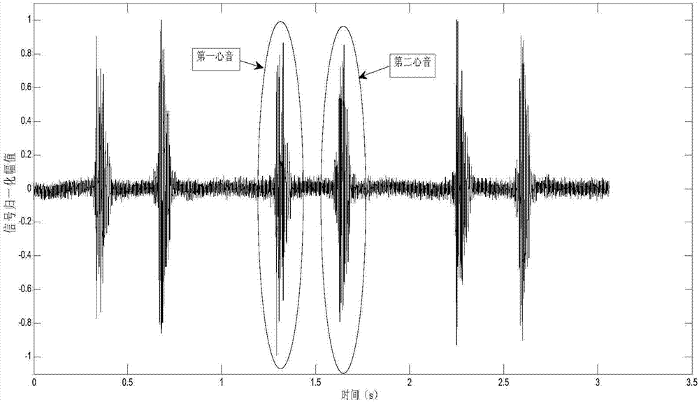 Heart rate calculating method based on heart sound signal autocorrelation analysis