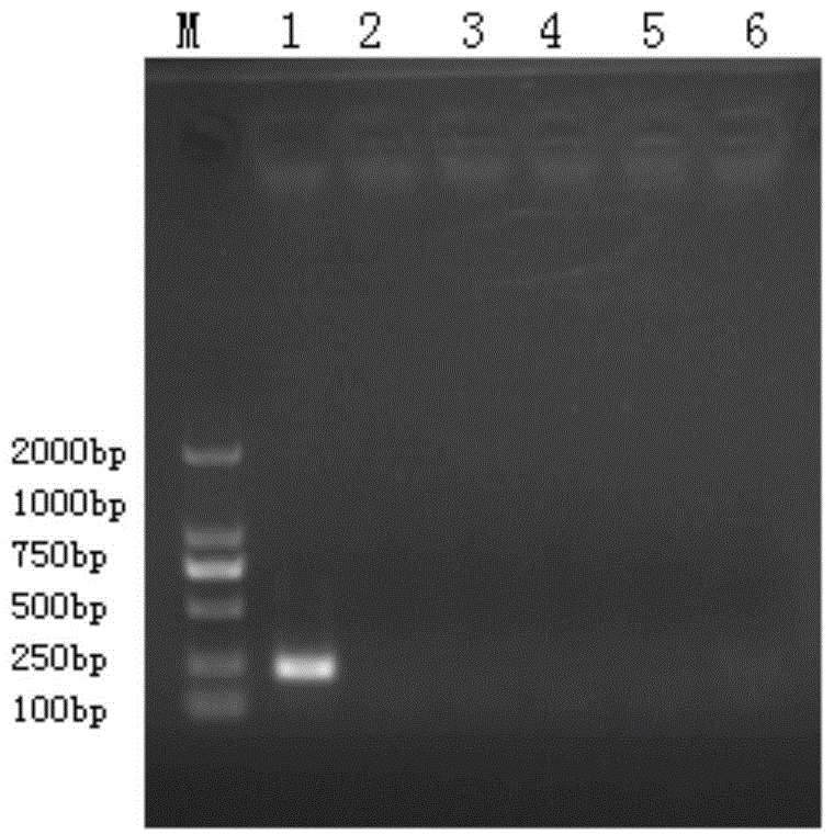 PCR detection primers and kits for bacterial drug resistance gene ndm-1