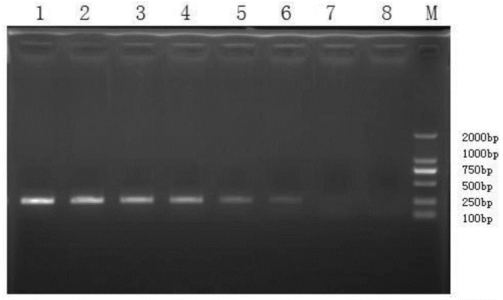 PCR detection primers and kits for bacterial drug resistance gene ndm-1