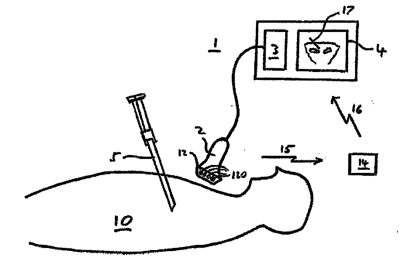 System for ultrasound image guided procedure