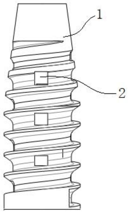 A zinc-manganese-magnesium alloy interface screw for reconstruction and fixation of anterior cruciate ligament