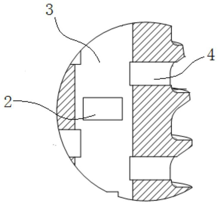 A zinc-manganese-magnesium alloy interface screw for reconstruction and fixation of anterior cruciate ligament