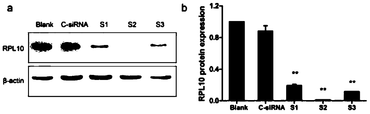 Application of inhibitor of rpl10 in preparation of medicine for treating ovarian cancer