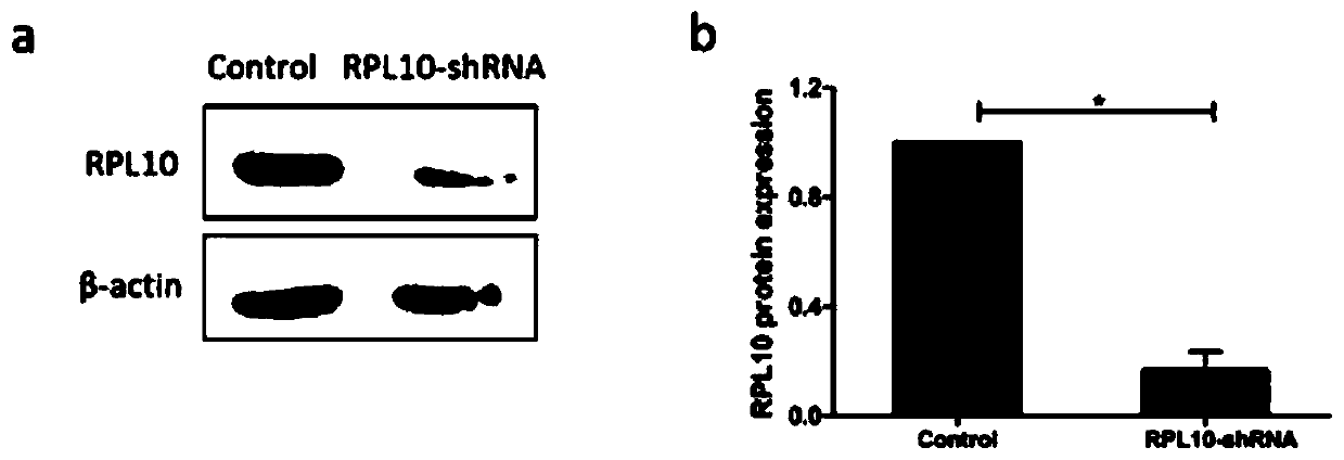 Application of inhibitor of rpl10 in preparation of medicine for treating ovarian cancer