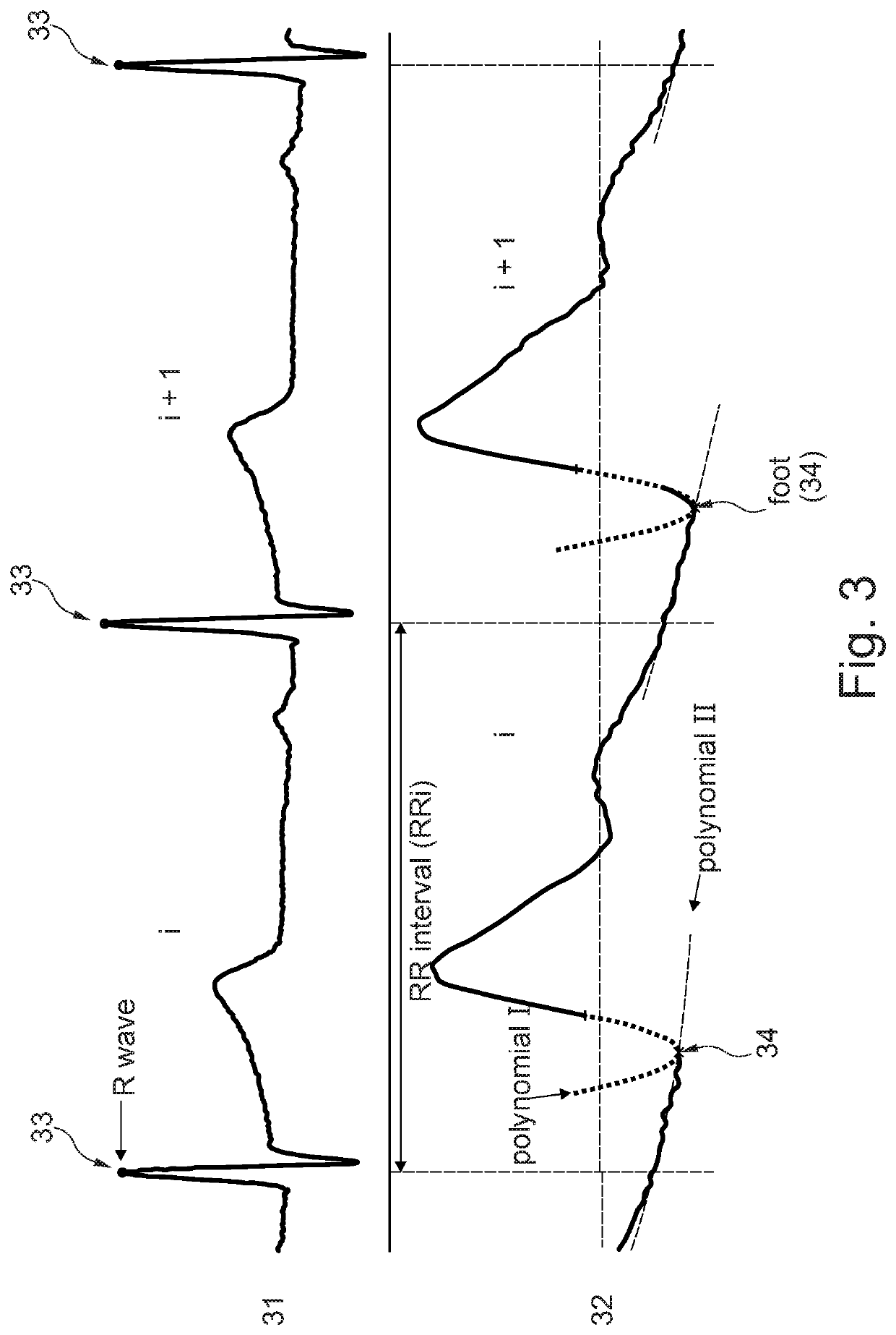 Device and method for monitoring and diagnosing the autoregular mechanism of the blood pressure of a living being