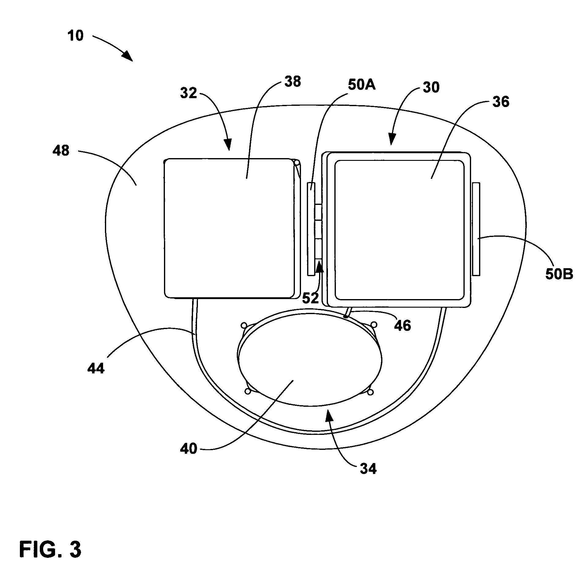 Implantable medical device with a nonhermetic battery