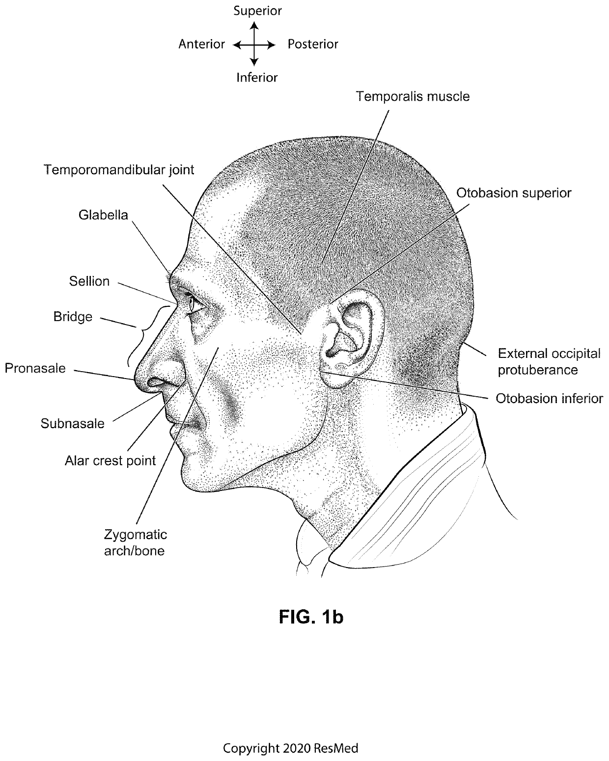 Positioning, stabilising, and interfacing structures and system incorporating same