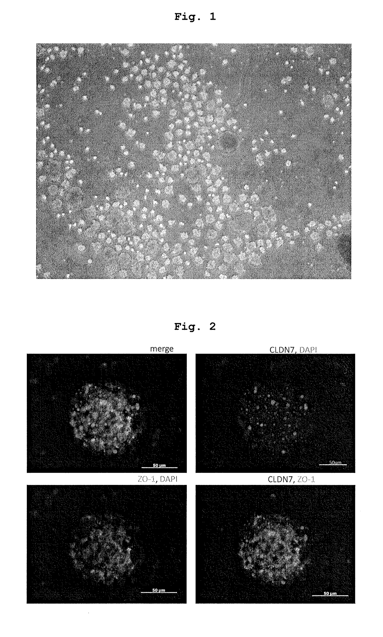 Method for producing therapeutic corneal endothelial substitute cell sphere