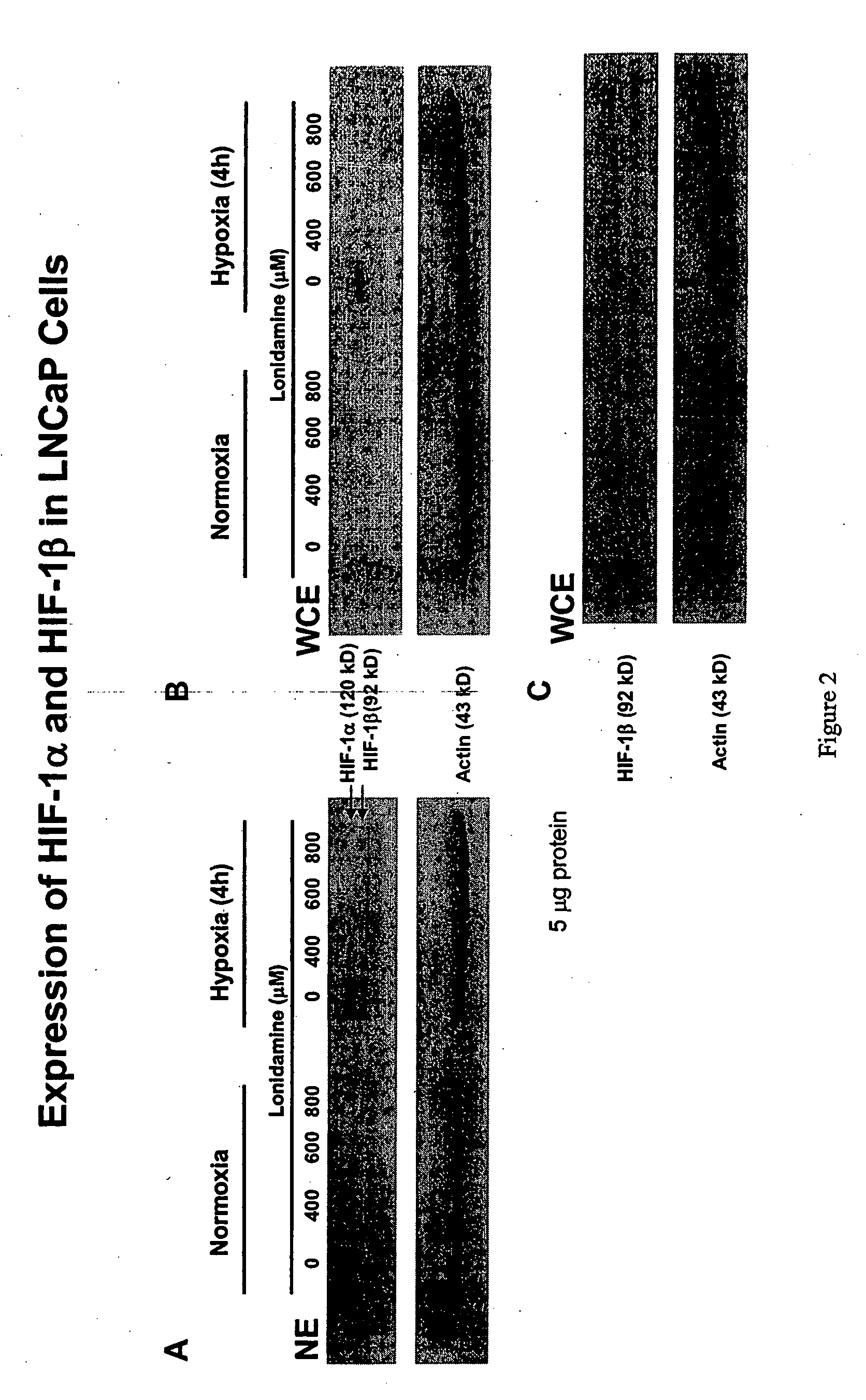 Prevention and treatment of benign prostatic hyperplasia using lonidamine and lonidamine analogs