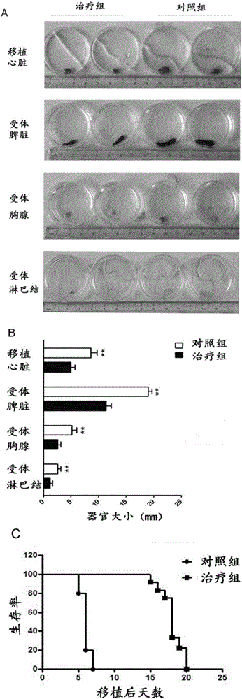 Mir-29 and application of inhibitor thereof in preparing medicine resisting organ transplant rejection