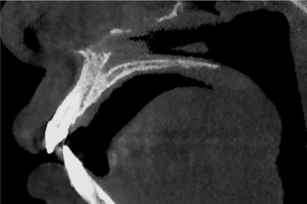 A method and system for analyzing oral cbct image information