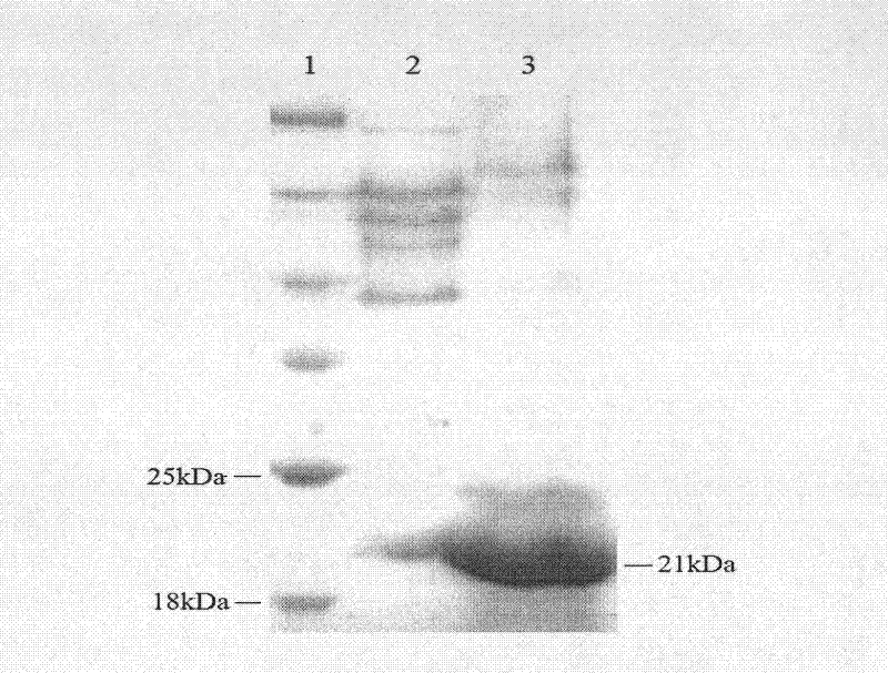 Constitutive expression cassette of Trichoderma reesei, expression vector, and recombinant strain and application thereof