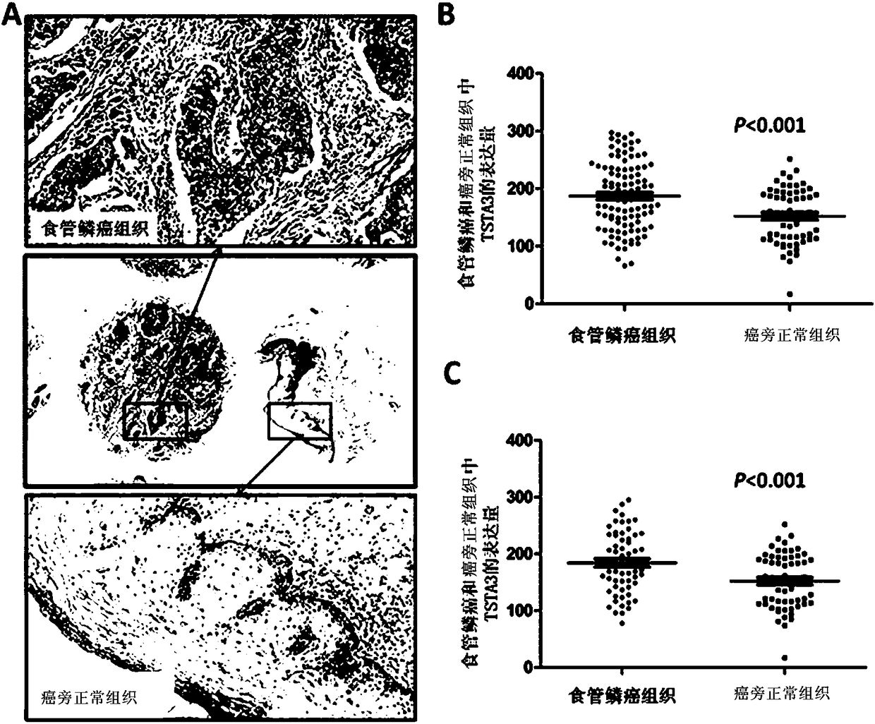 Application of tumor-specific transplantation antigen protein tsta3 in the preparation of diagnostic reagents for esophageal squamous cell carcinoma