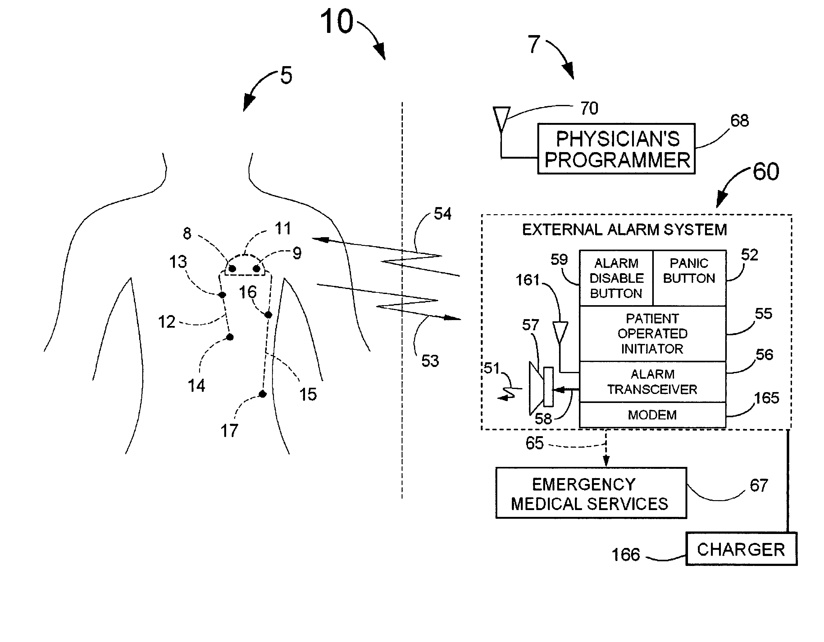 System for the detection of cardiac events