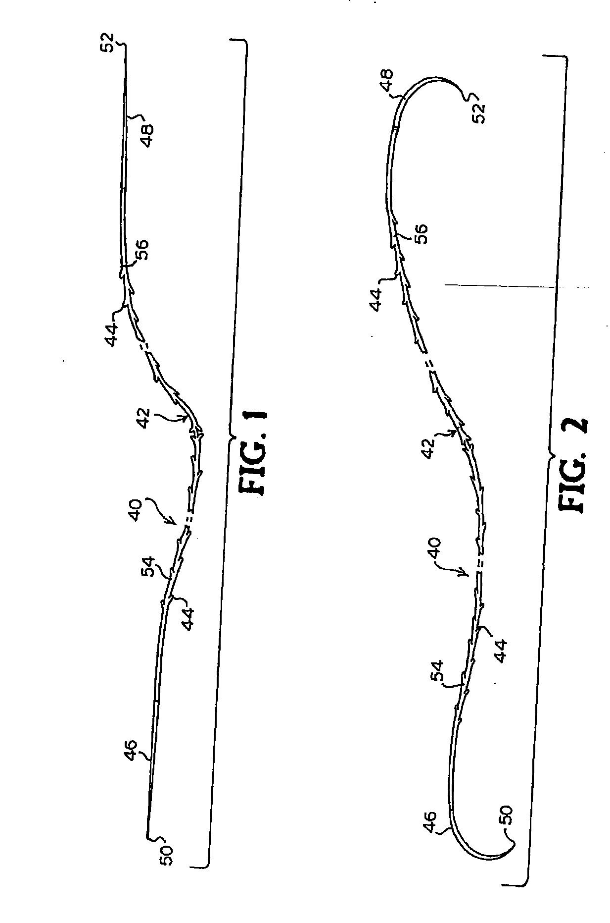 Suture Method