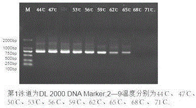 Trichomonad nested PCR detection kit and preparation method