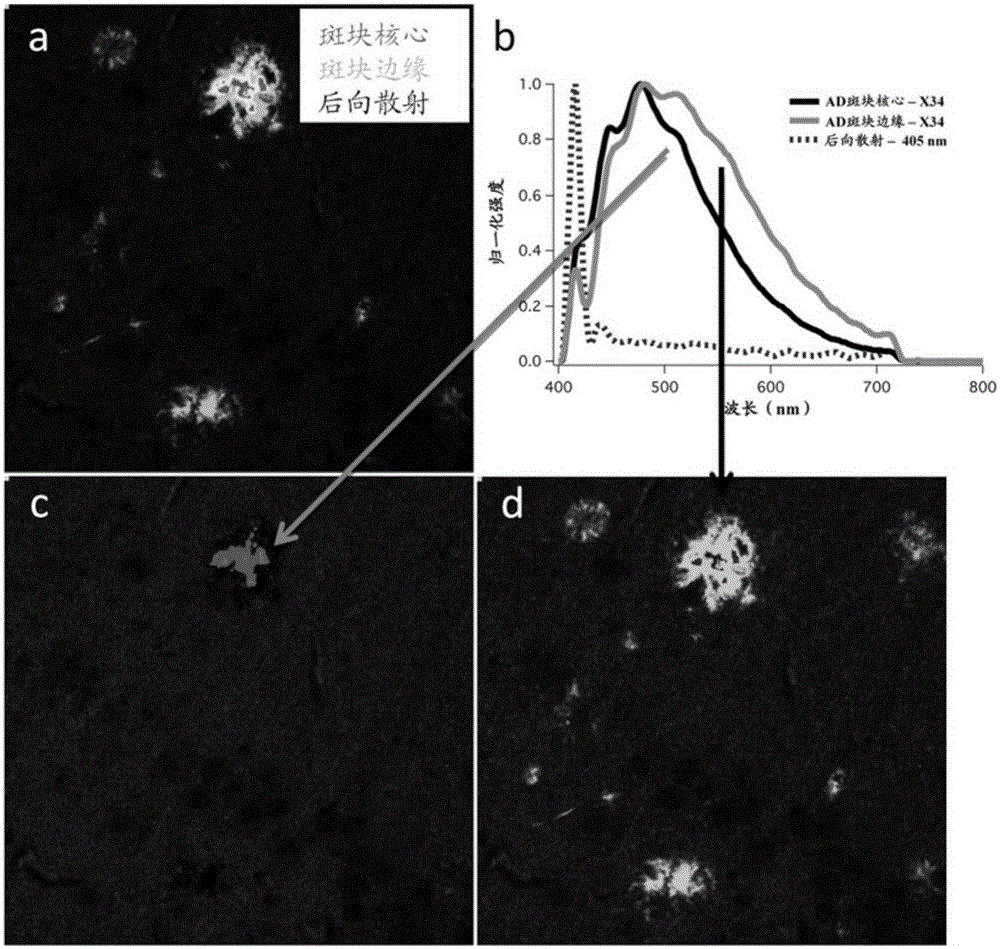 Methods for analyzing blood to detect diseases associated with abnormal protein aggregation