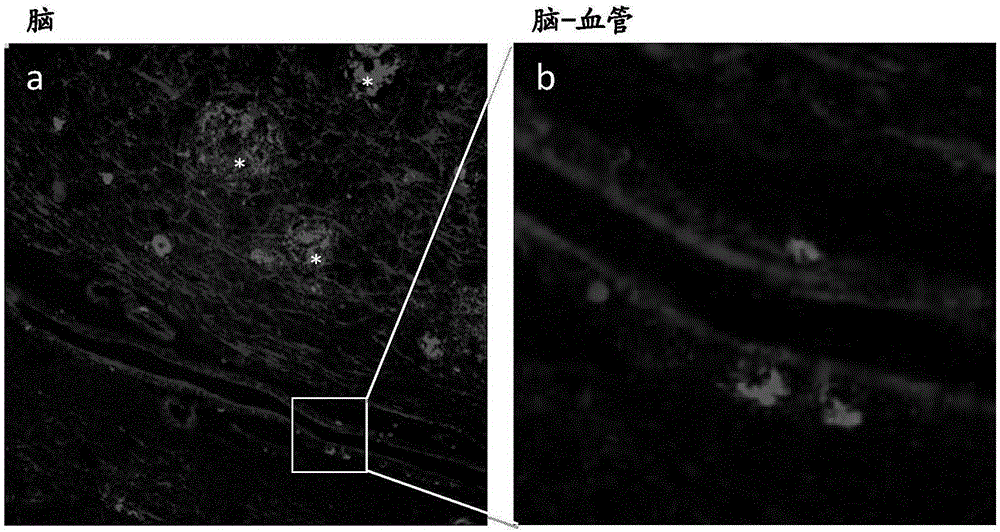 Methods for analyzing blood to detect diseases associated with abnormal protein aggregation