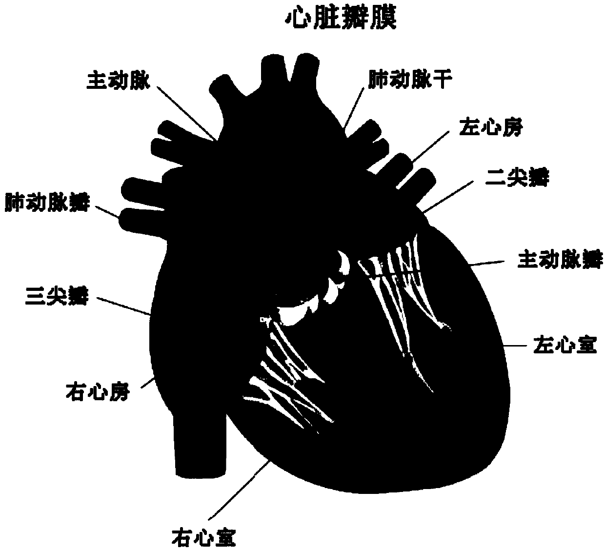 Adjustable externally implanted aortic valve forming ring