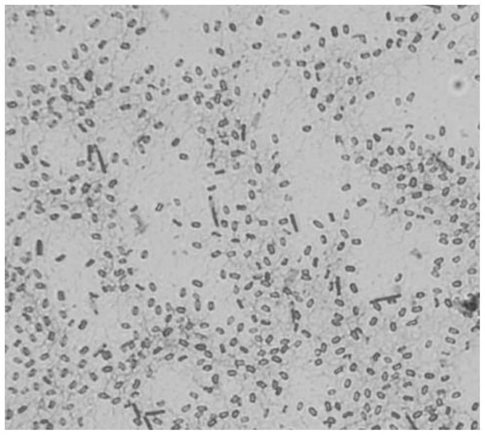 A strain of Bacillus subtilis and its fermentation method and application