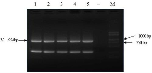 Methods for prokaryotic expression, eukaryotic expression, purification and monoclonal antibody preparation of V protein of peste des petits ruminants