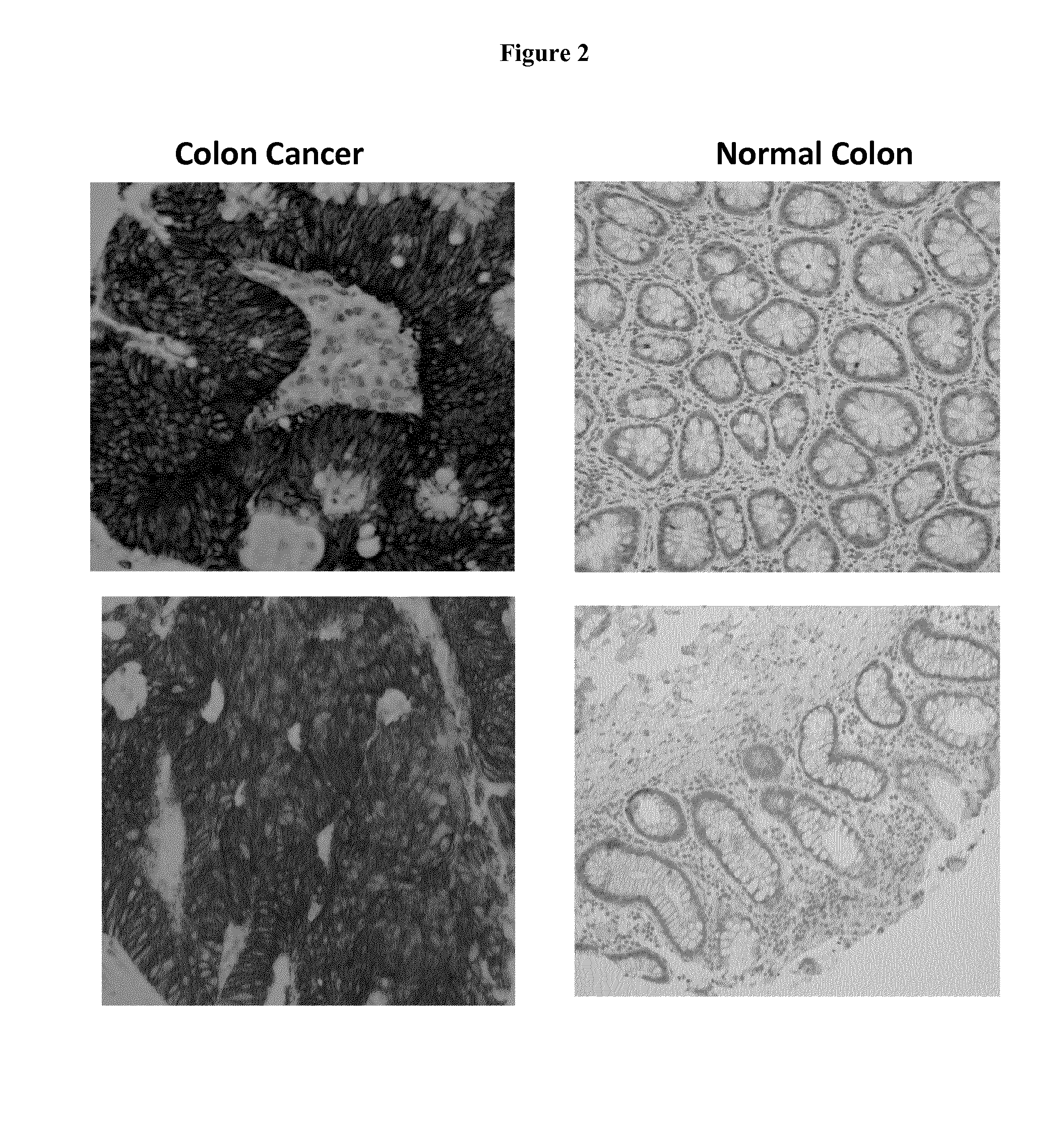 Tumor marker, monoclonal antibodies and methods of use thereof