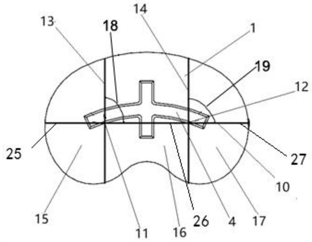 Biocompatible gradient bone trabecula artificial knee joint tibial plateau