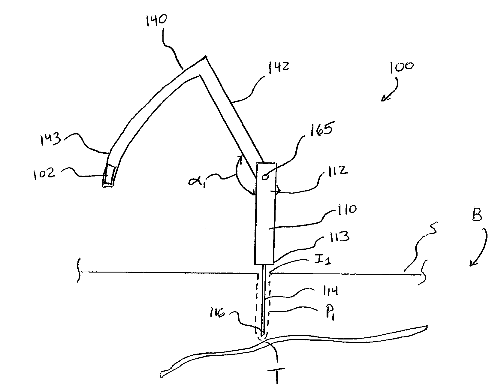 Methods and apparatus for implanting electronic implants within the body