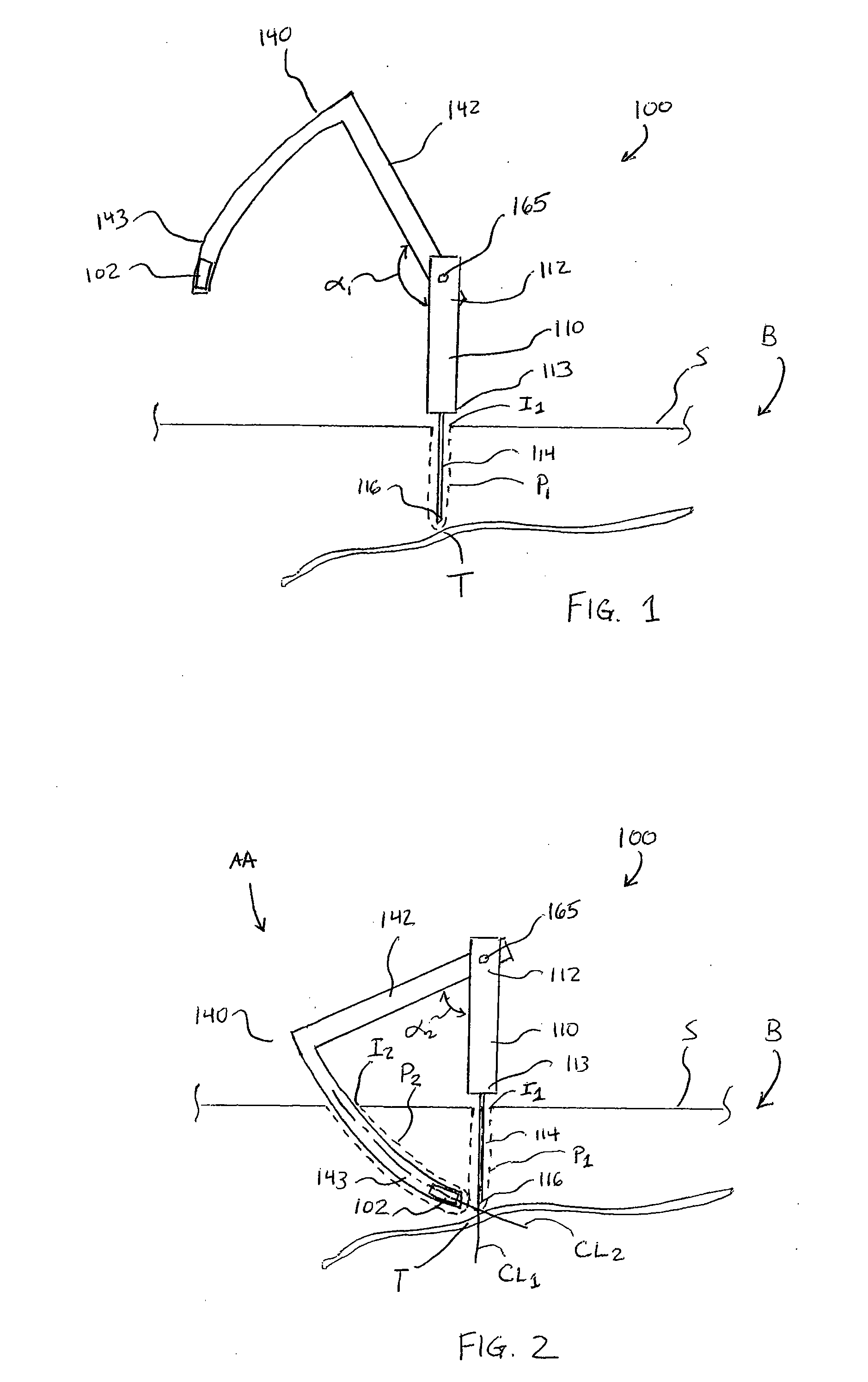 Methods and apparatus for implanting electronic implants within the body