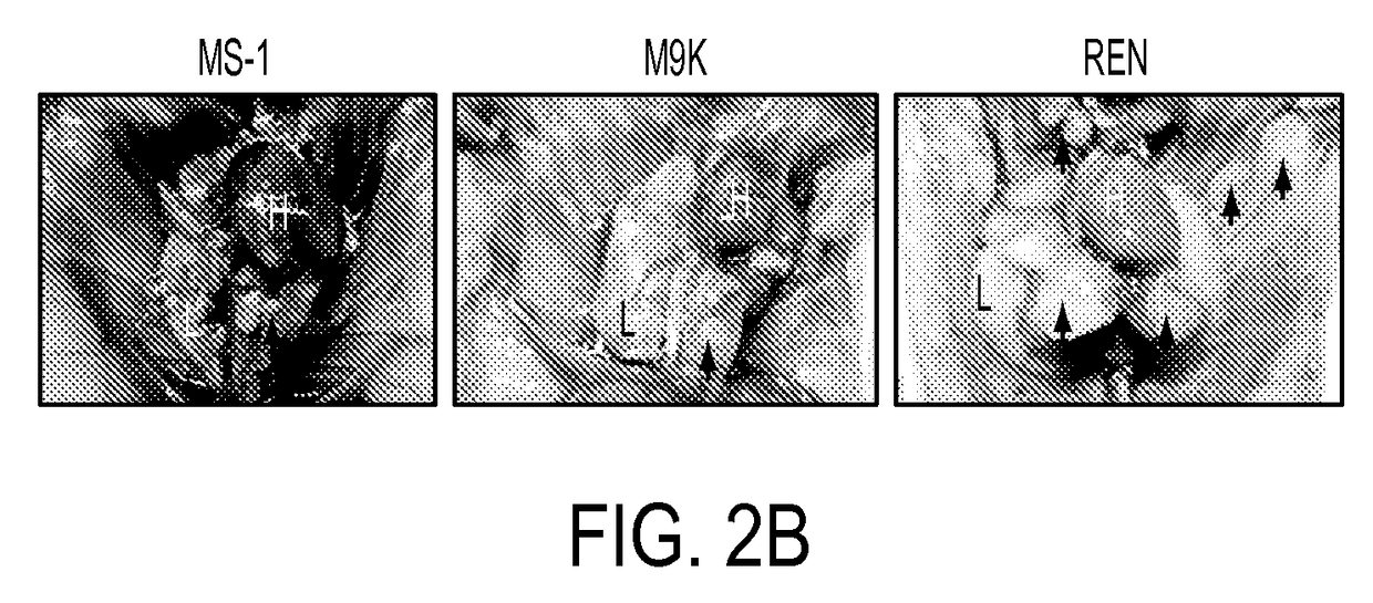 Suppression of malignant mesothelioma by overexpression or stimulation of endothelial protein C receptors (EPCR)