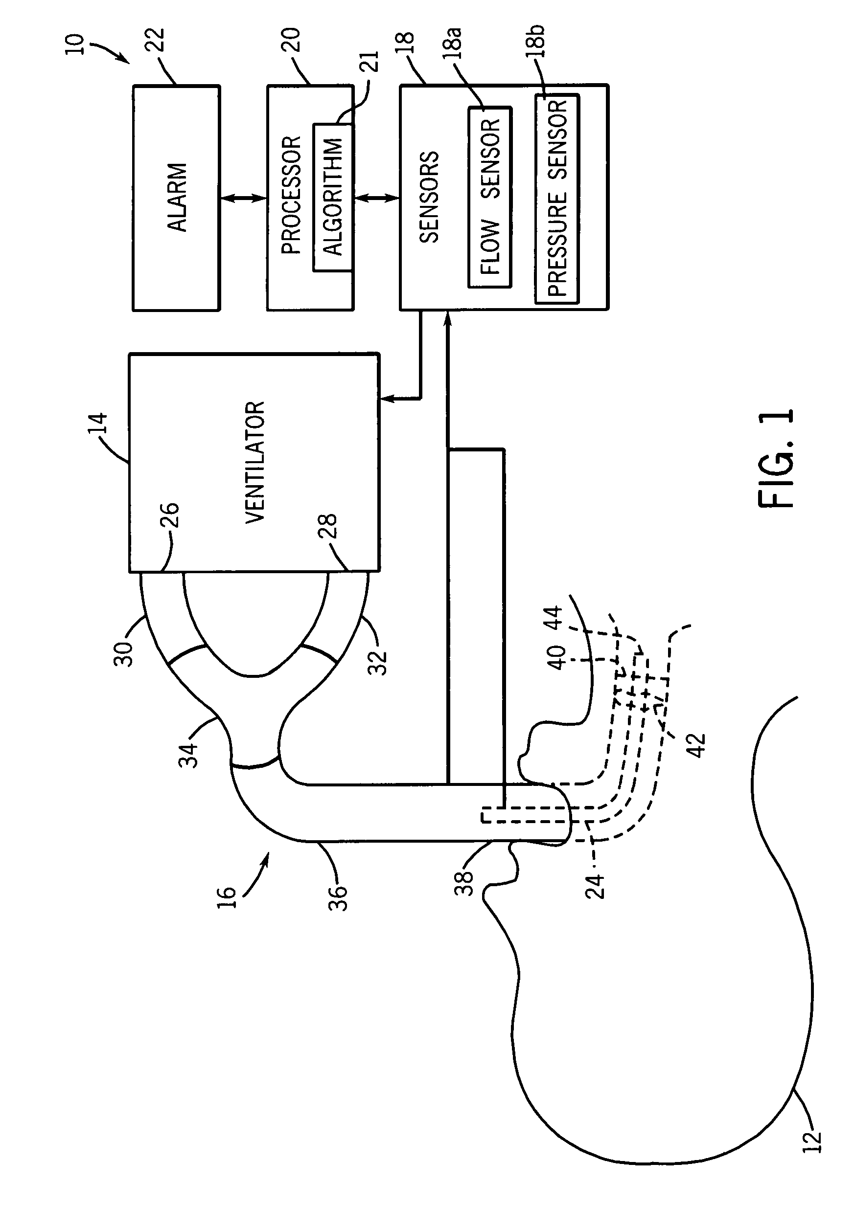 Method and system for detecting breathing tube occlusion
