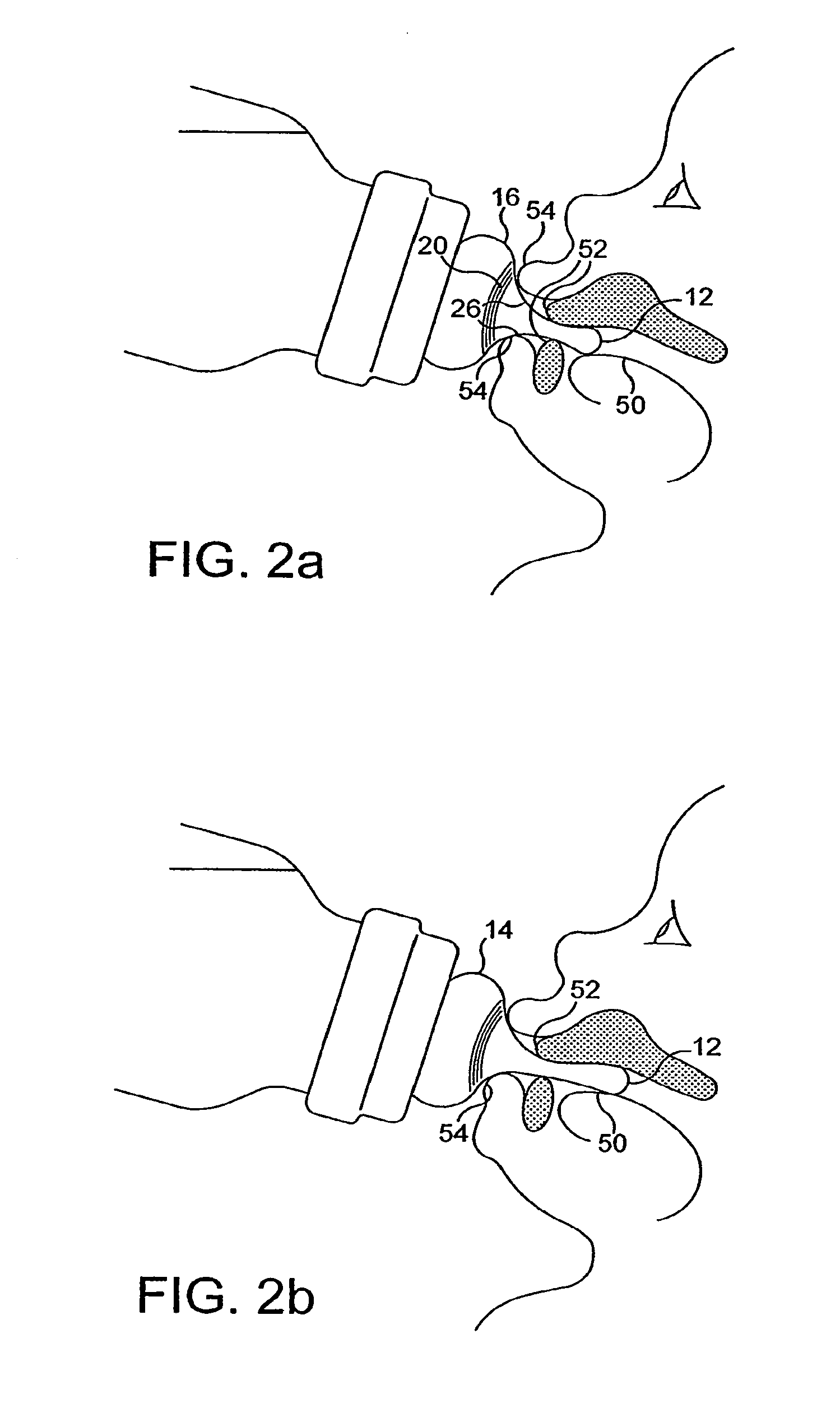 Baby Bottle With Flexible Nipple Regions