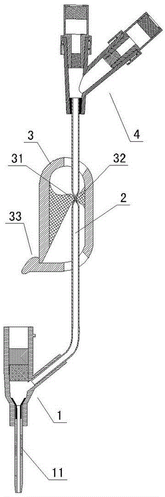 Remaining needle with elastic contact