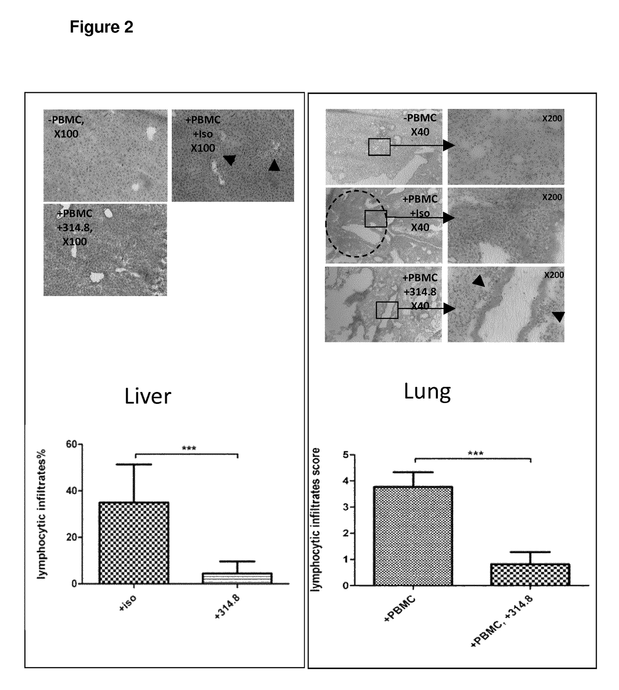 Antibodies directed against ICOS for treating graft-versus-host disease